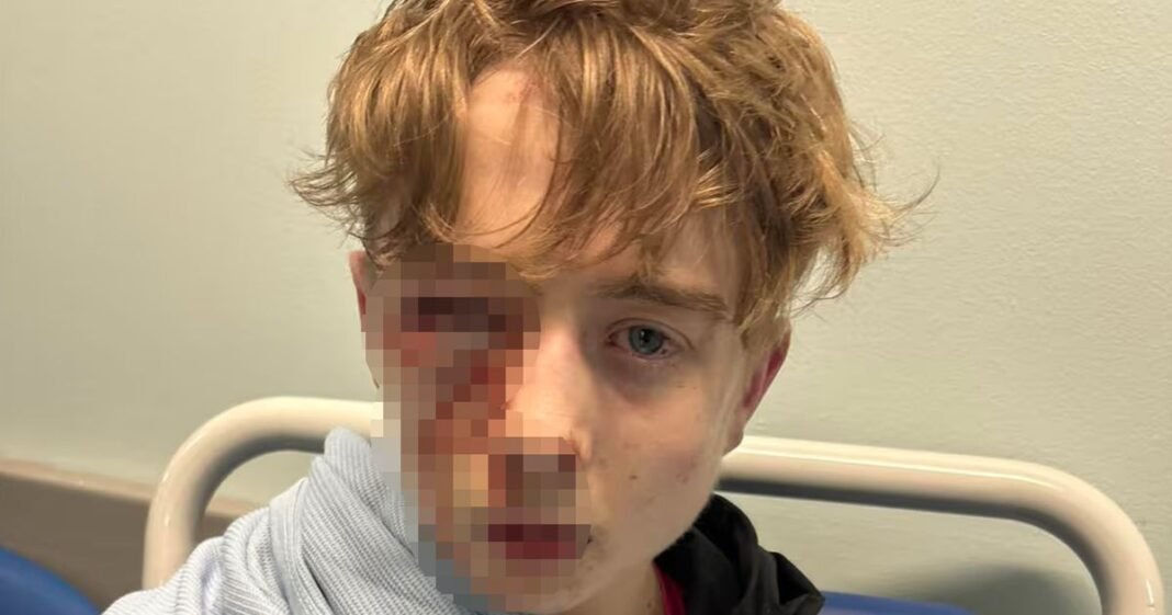 “Boy Injured Defending Friend Against Gang Attack”